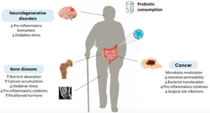 How Prebiotics, Probiotics, and Postbiotics Help Maintain a Healthy Gut in Senior Citizens
