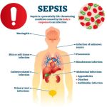 🧓 Sepsis in Senior Citizens: Awareness and Prevention